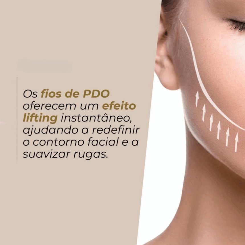 Fios de PDO