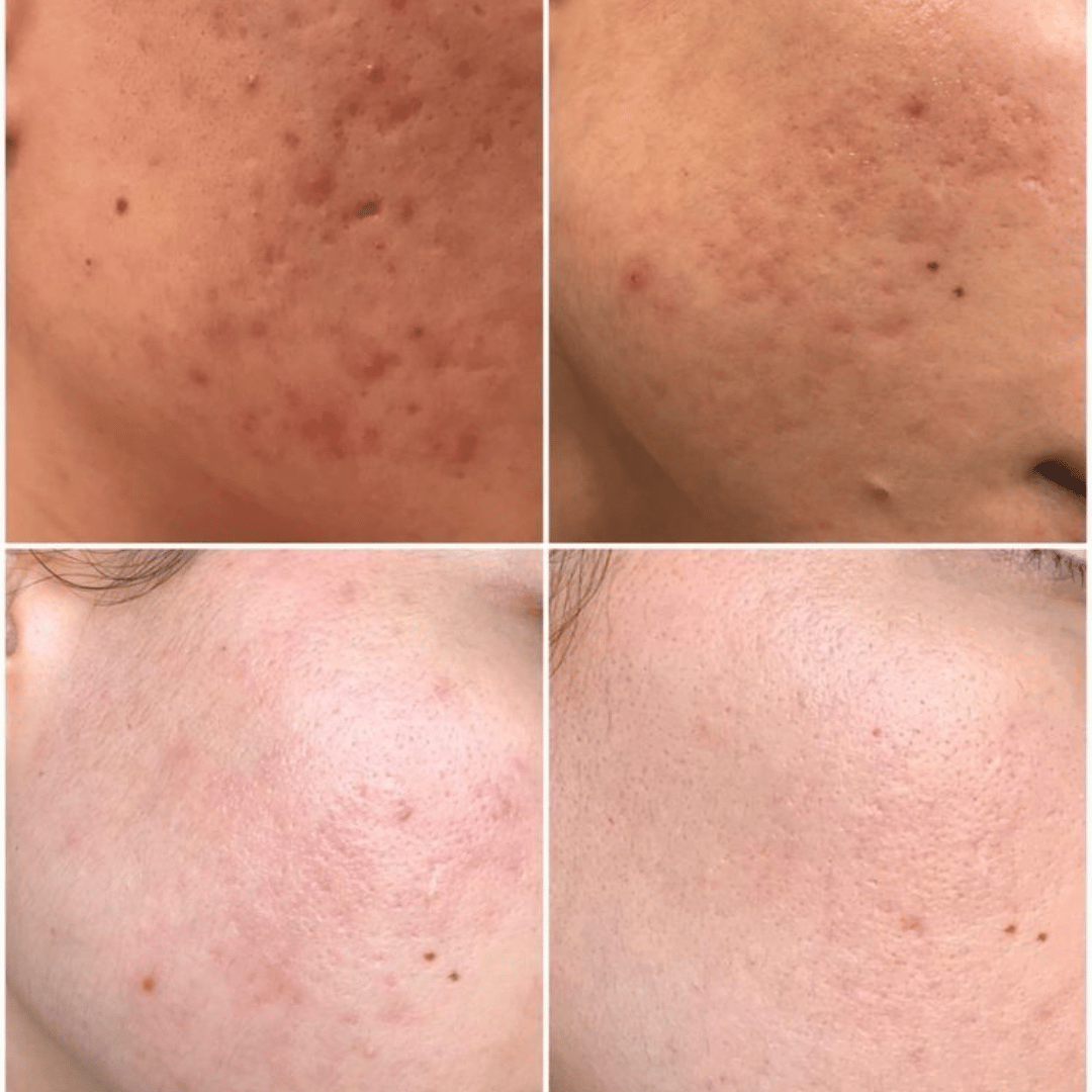 #5C346C - 2025-07-22T194340.812